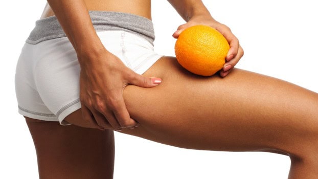 Cellulite, quali rimedi?