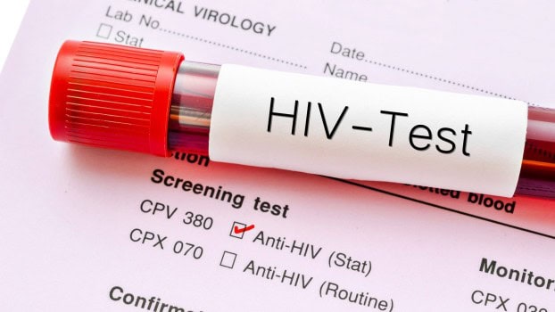 Anticorpi anti HIV 1-2